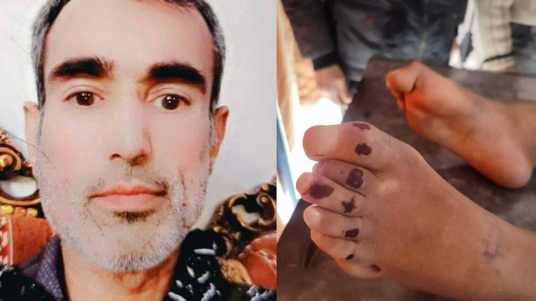 Lawyer dies under torture in Afrin