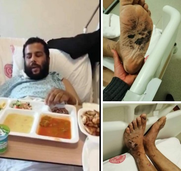 أدلة إضافية على التعذيب والقتل في سجون “الجيش الوطني” المدعوم من تركيا