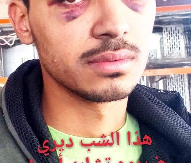 التعذيب بطريقة وحشية… من قبل”الشرطة العسكرية” بجرابلس