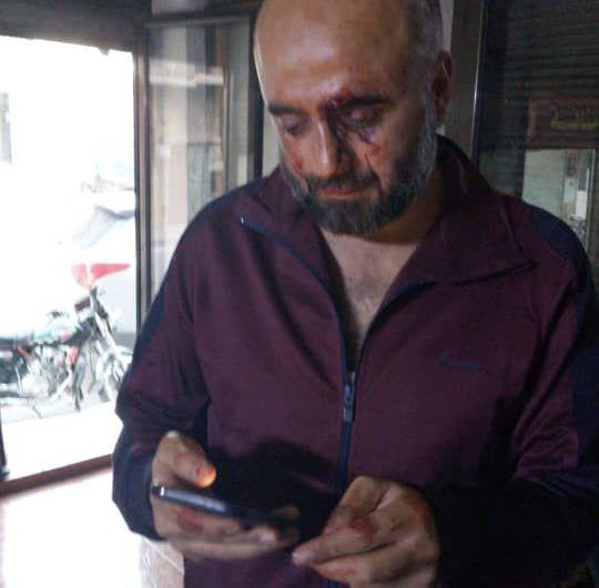 فلتان أمني: سلبوا منه قرابة نصف مليون دولار… صراف سوري يتعرض لسطو مسلح شمال حلب