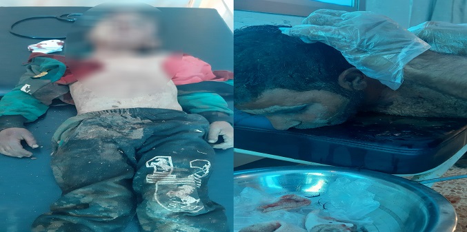 مقتل طفل في انفجار لغم شمالي الرقة