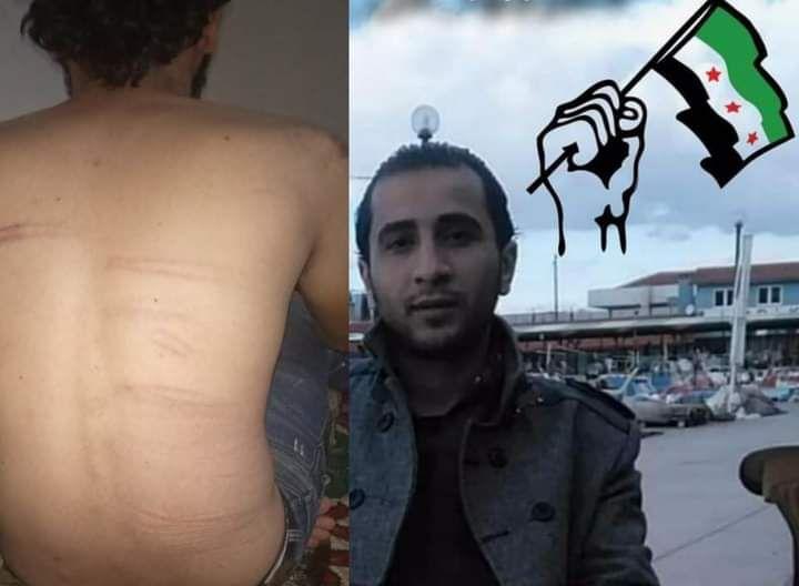 الإعتداء على إعلامي واعتقاله داخل مشفى تل أبيض من قبل مسلحي “الجيش الوطني” الموالي لتركيا