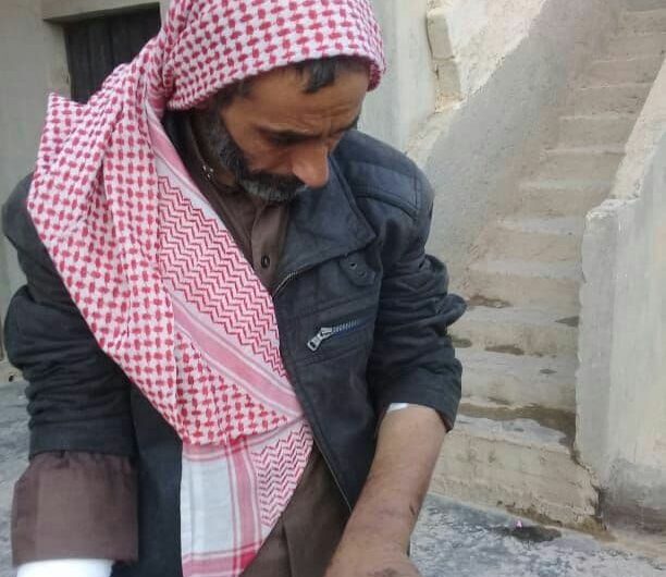 صور صادمة : عمليات التعذيب مستمرة في سجون الفصائل الموالية لتركيا شمال سوريا