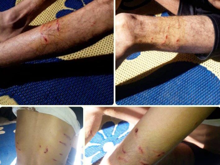 وسيلة تنكيل وتعذيب جديدة … الجندرمة التركية تطلق كلاب “مسعورة” لنهش أجساد اللاجئين على الحدود السورية