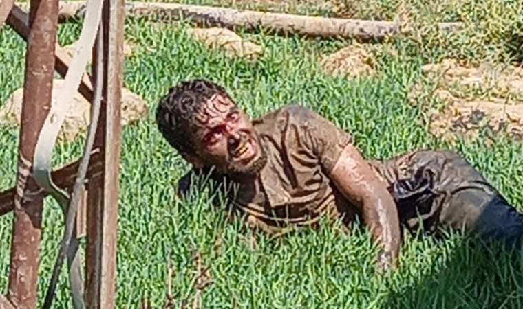 انتقادات واسعة لطريقة تعاطي “الاعلام التركي” الرسمي مع واقعة وفاة لاجئ سوري نتيجة “عضة كلب”